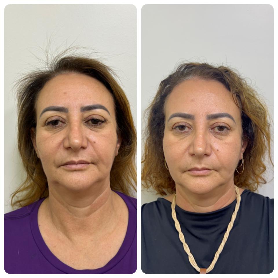 WhatsApp Image 2025-11-04 at 15.15.33