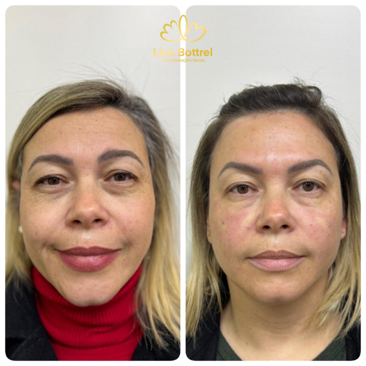 WhatsApp Image 2025-11-04 at 15.17.04